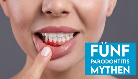 Frau mit ge&ouml;ffnetem Mund zeigt auf entz&uuml;ndetes Zahnfleisch