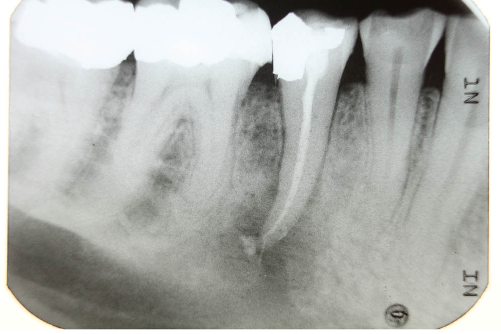 R&ouml;ntgenaufnahme 2D DVT AllDent 